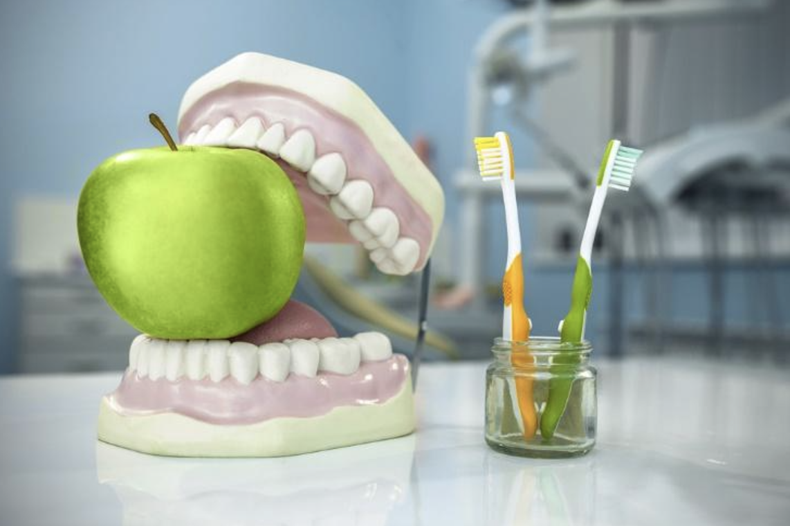 Dental Implants